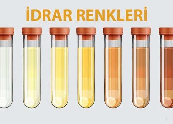 İdrar Renkleri